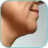 Facial pain and discomfort