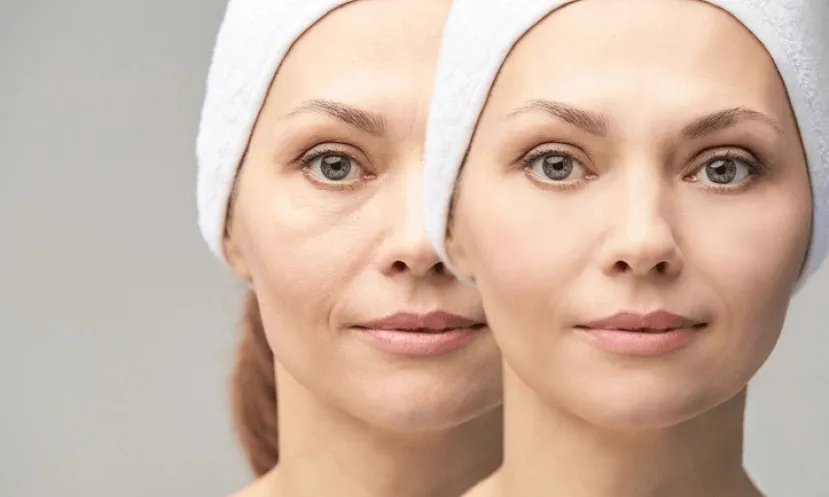 Personalized Dermal Filler Solutions for a Youthful, Radiant You