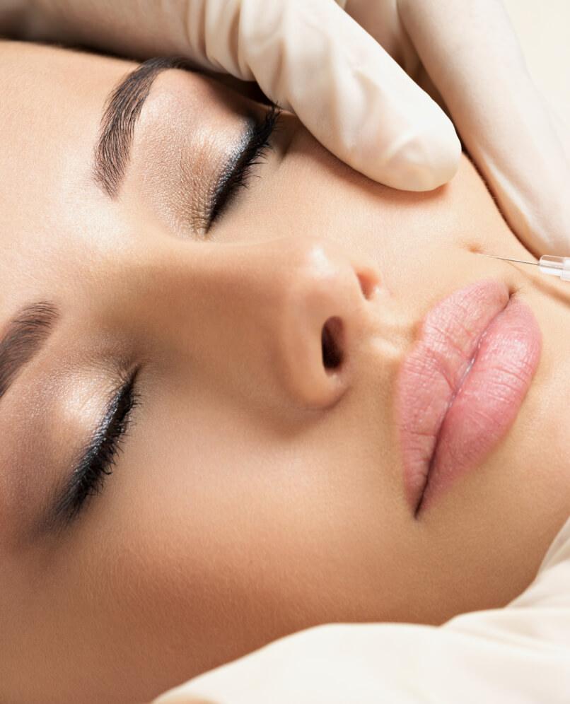 Baby Botox® Injection