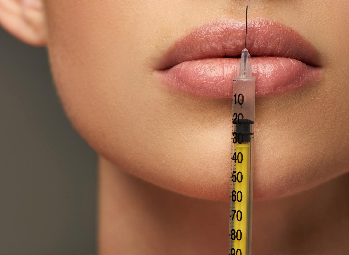 Botox Lip Flip
