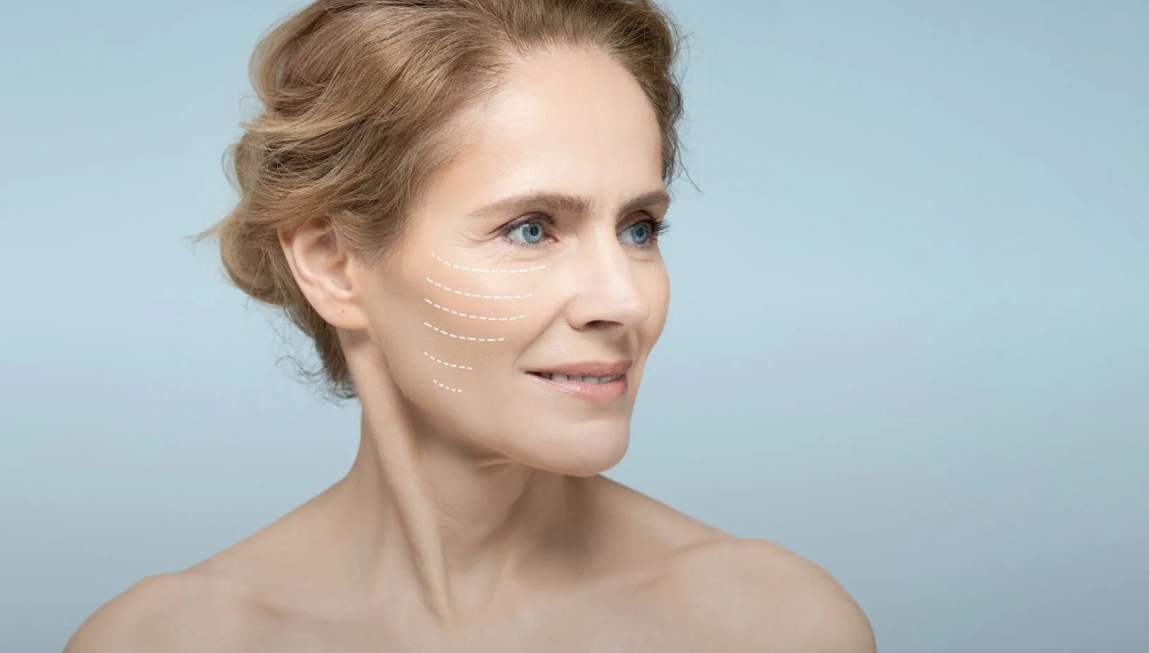 Who Are Collagen Injections Best For?