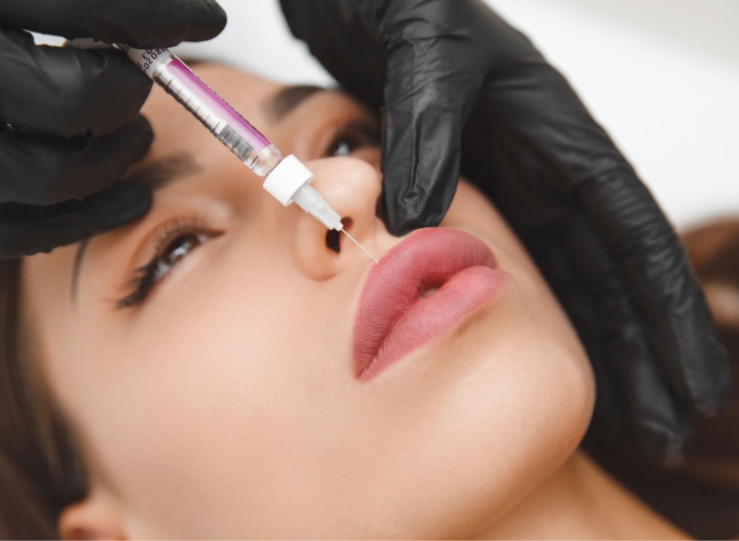 Dissolving Dermal Filler