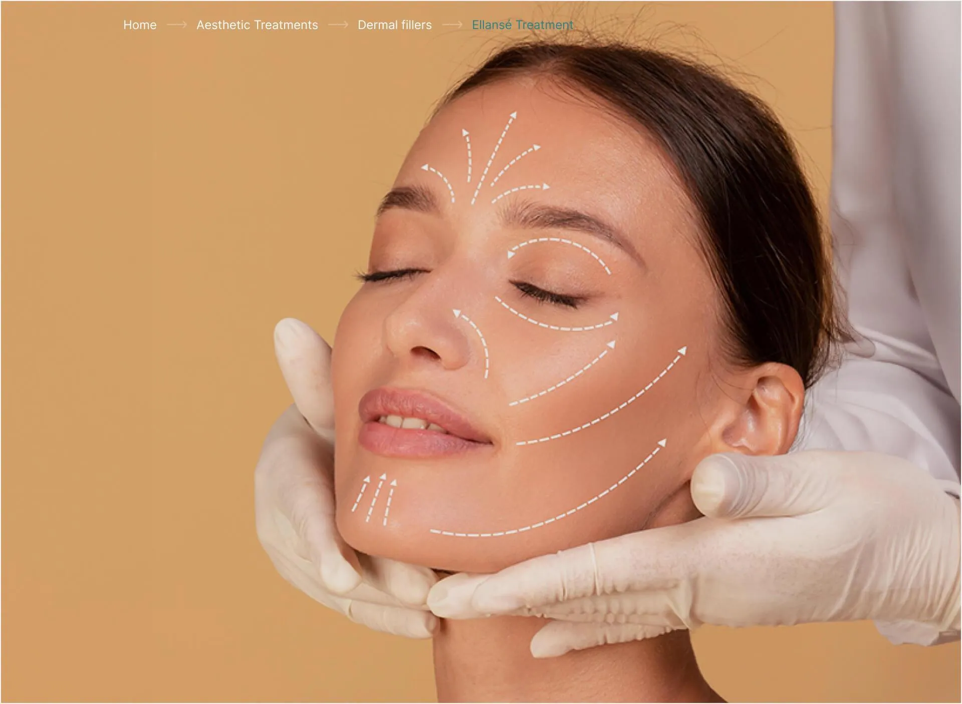 Ellansé Treatment Ellansé Treatment |rtwskin.co.uk