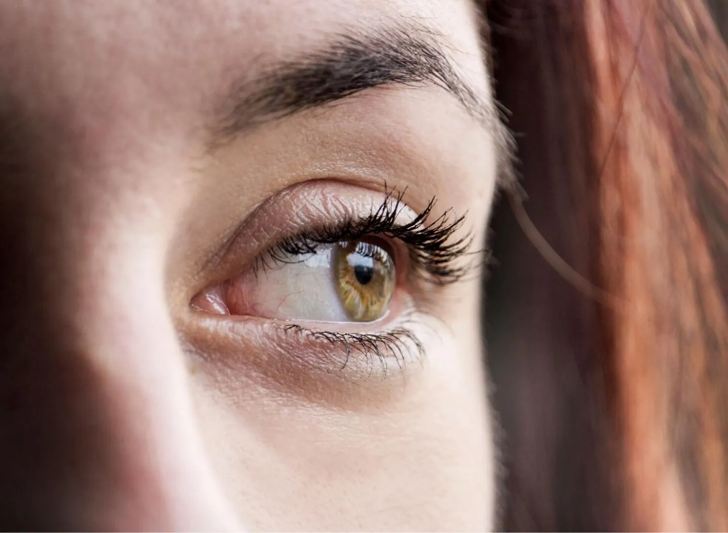 Fillers For Tear Trough