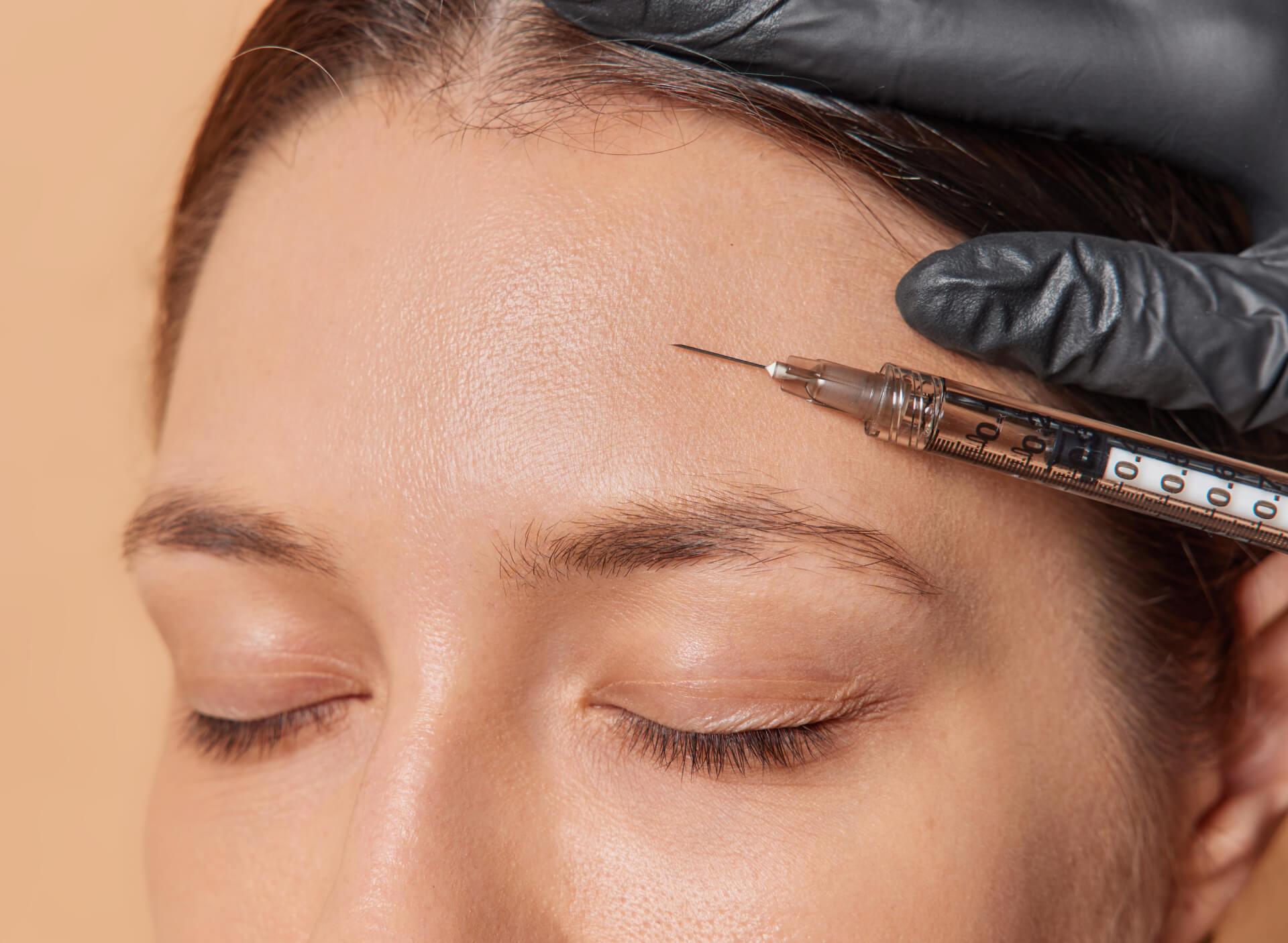 Frown Lines Botox