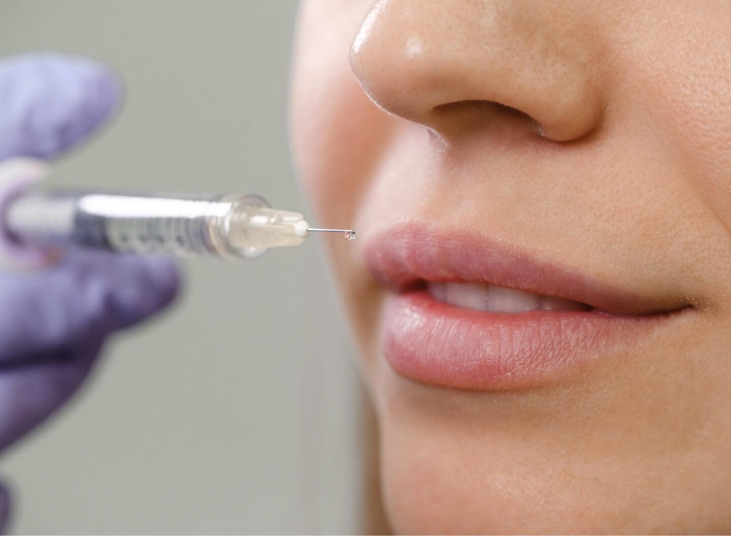 Lip Enhancement