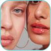 Plump lips and cheeks|rtwskin.co.uk