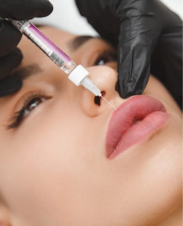 Dermal Fillers Correction m Dissolving Dermal Filler - rtwskin clinic