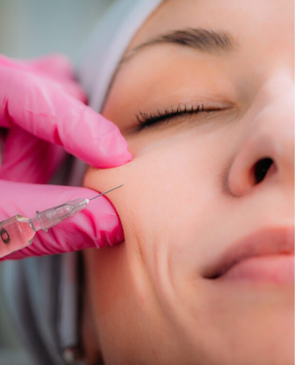 Fillers For Cheeks
