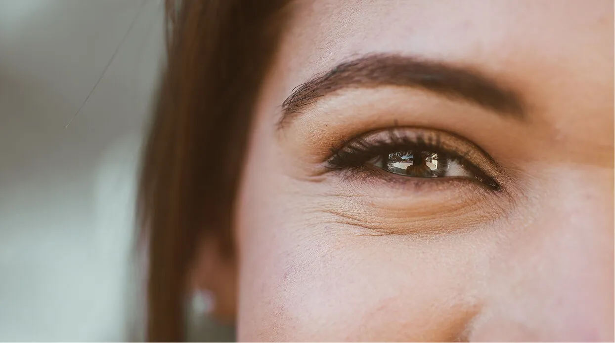 How does Botox and Crows feet treatment work?