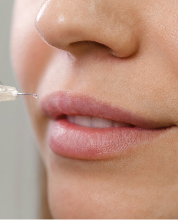 Lip Enhancement