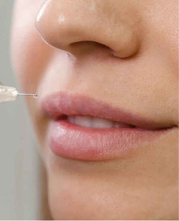 Lip Enhancement
