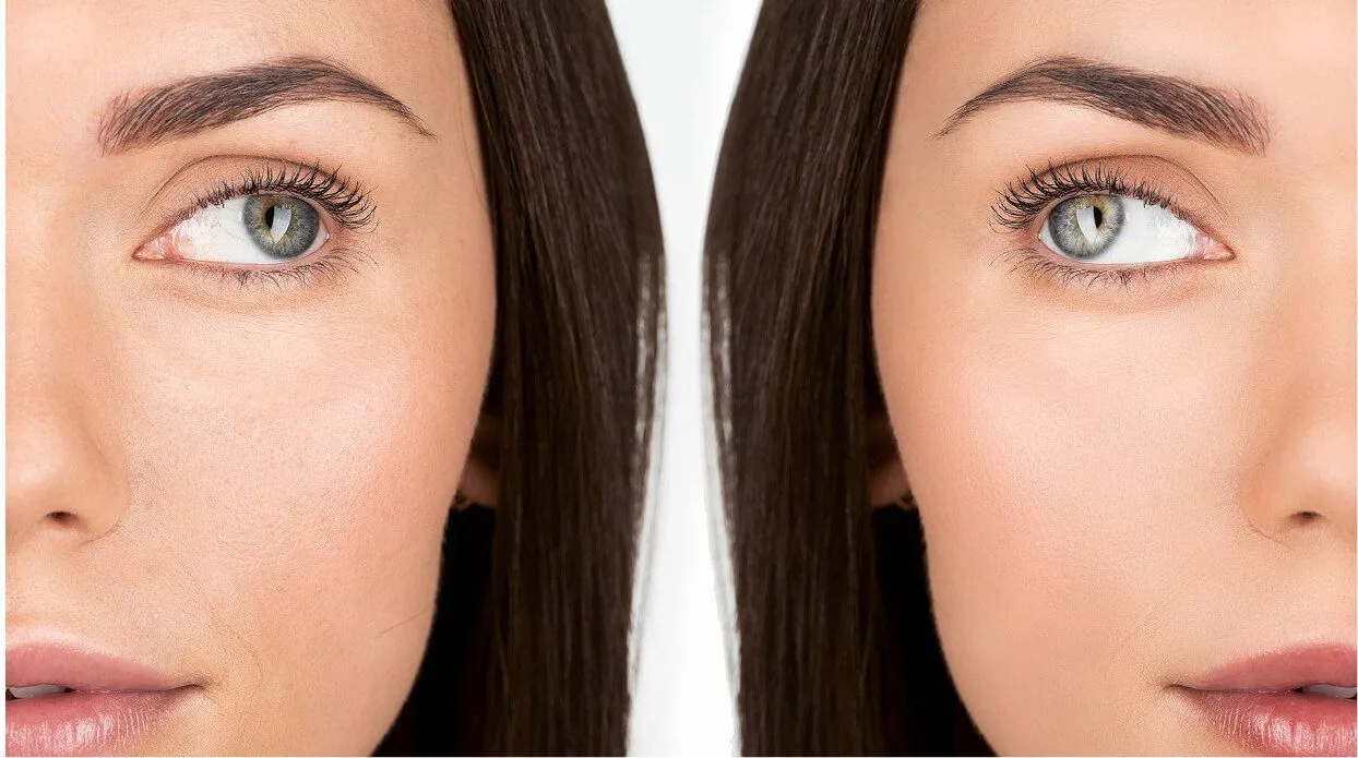 Long-Lasting and Effective Results
