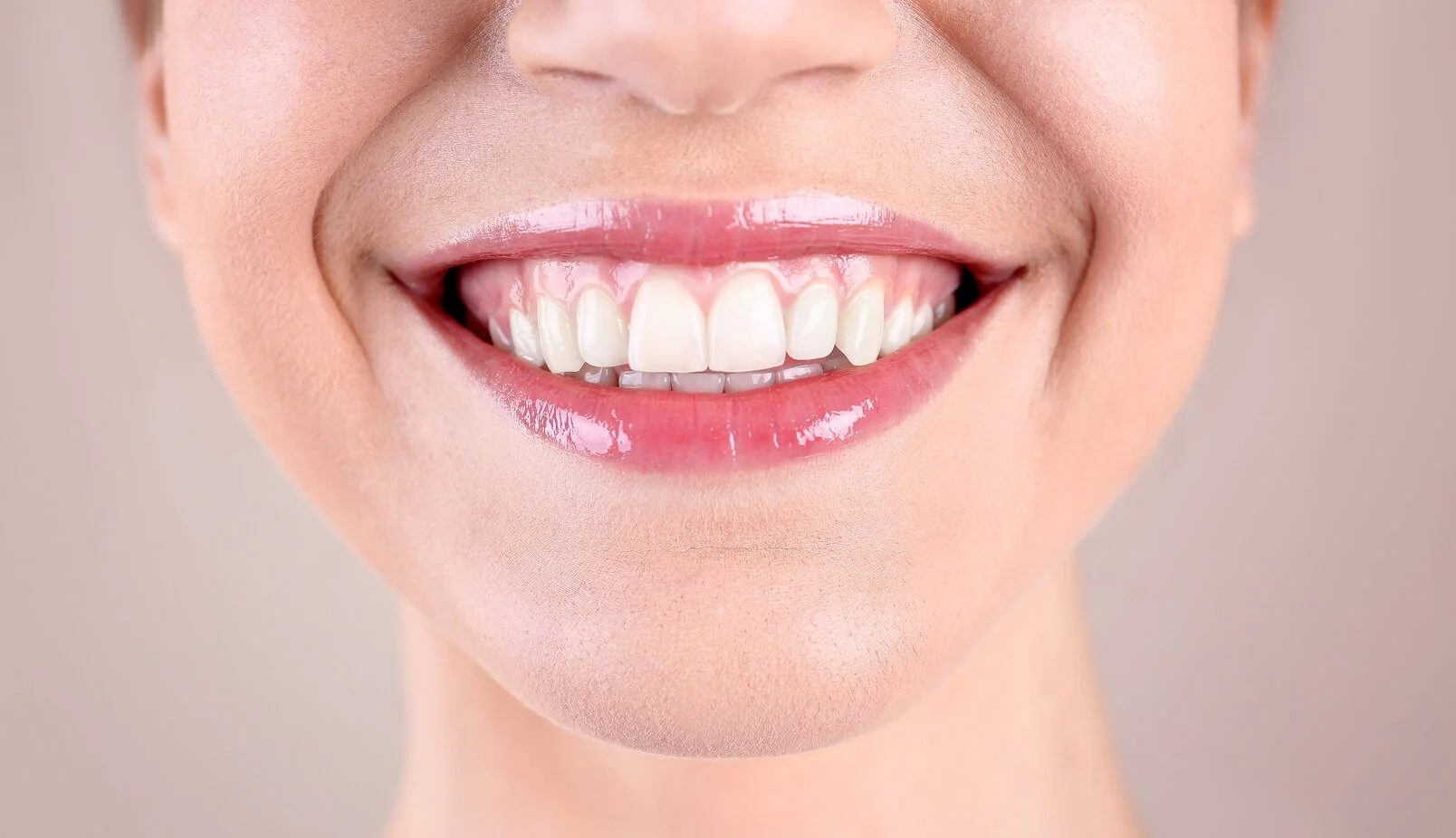 A close-up of a smile with visible gum tissue above the upper teeth, illustrating a gummy smile assessment at rtwskin in Tunbridge Wells.