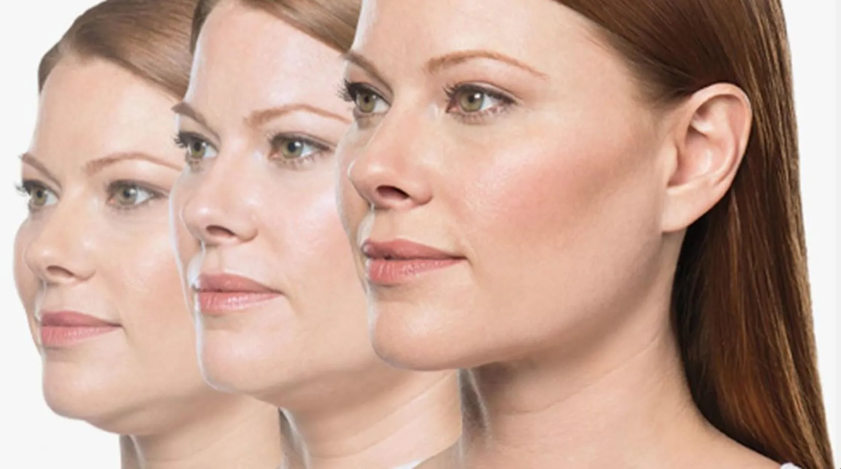 How Does Double Chin Treatment Work?