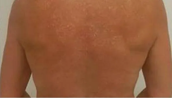 Result patient after