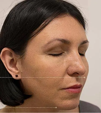 Result patient after