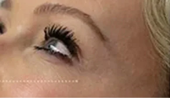 Result patient after