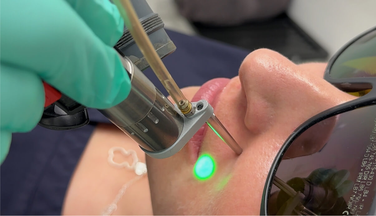 How It Works Ingrown Hair Removal How It Works
