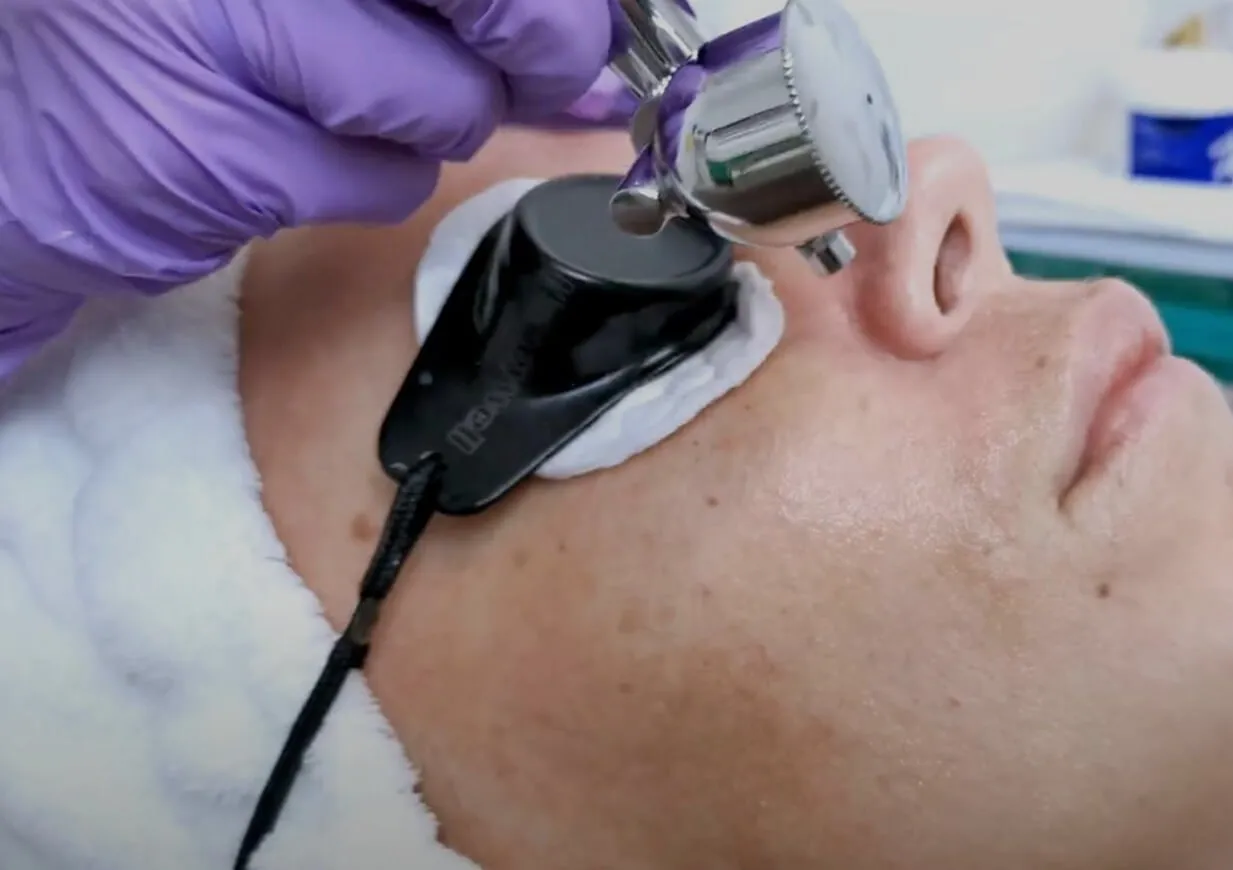 Aqua Jet Facial Stands Out?