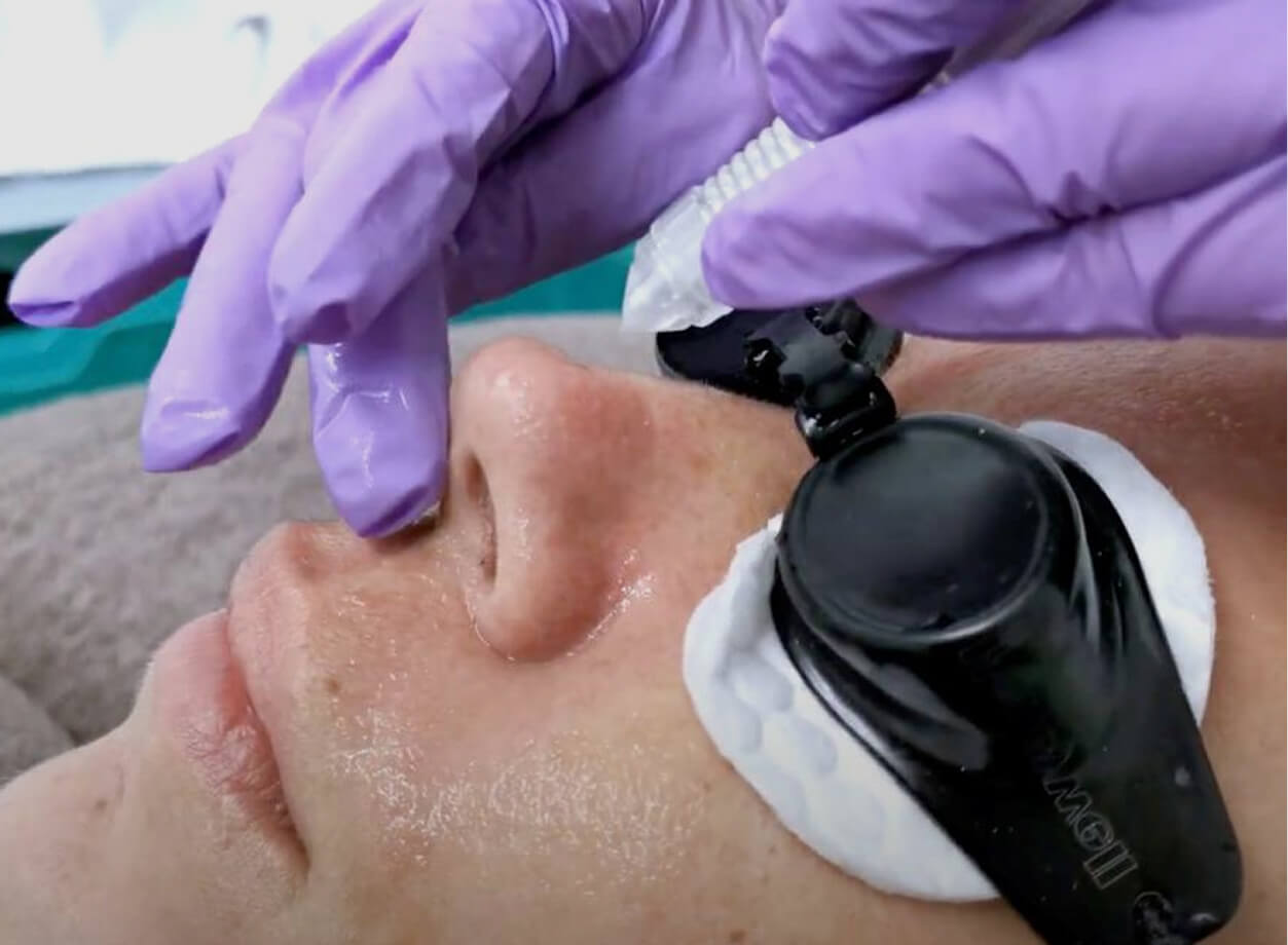 Aqua Jet Facial Stands Out