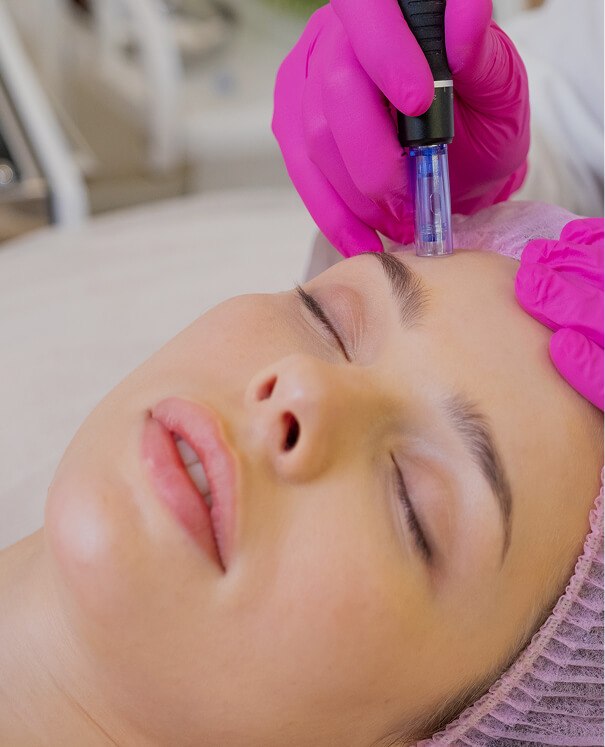 Dermapen