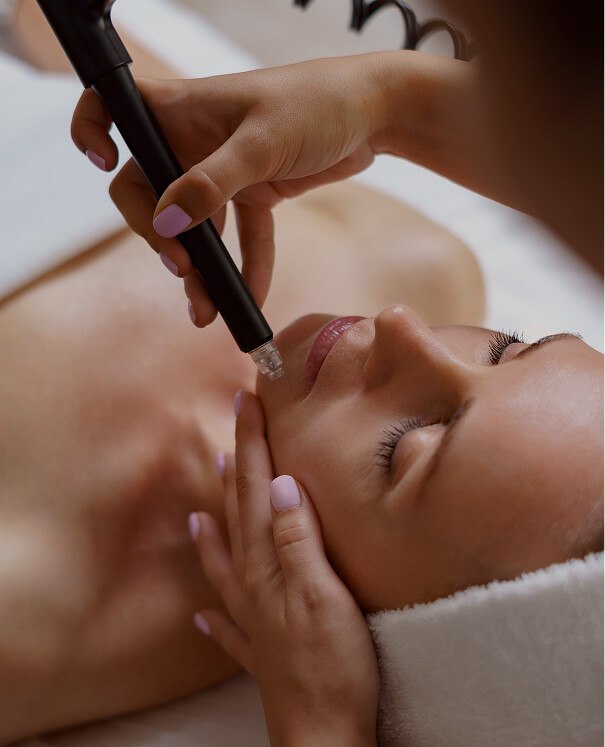 Microdermabrasion