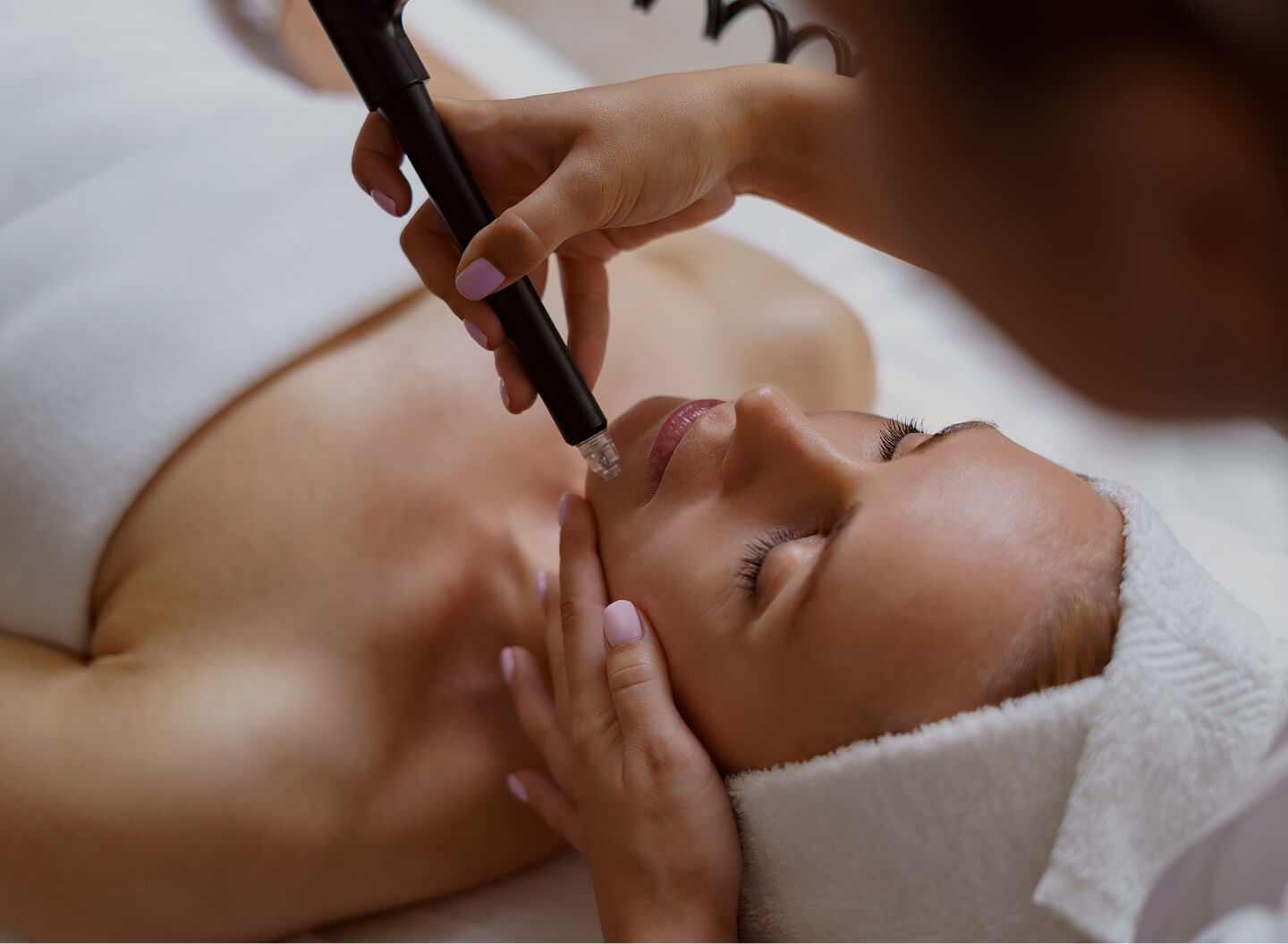 Microdermabrasion