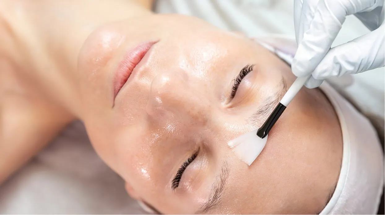 Chemical peeling cost and value
