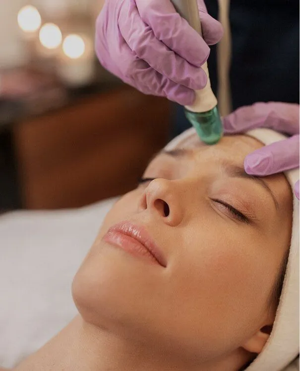 RF Microneedling & Dermaroller