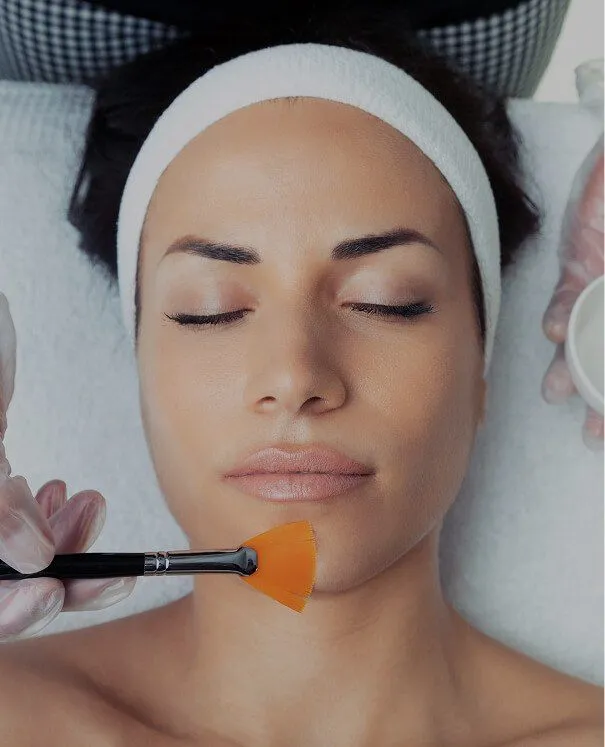 Chemical Peels