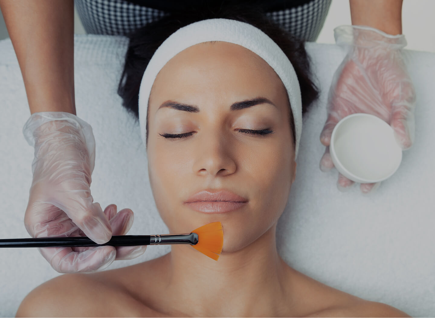 Chemical Peels