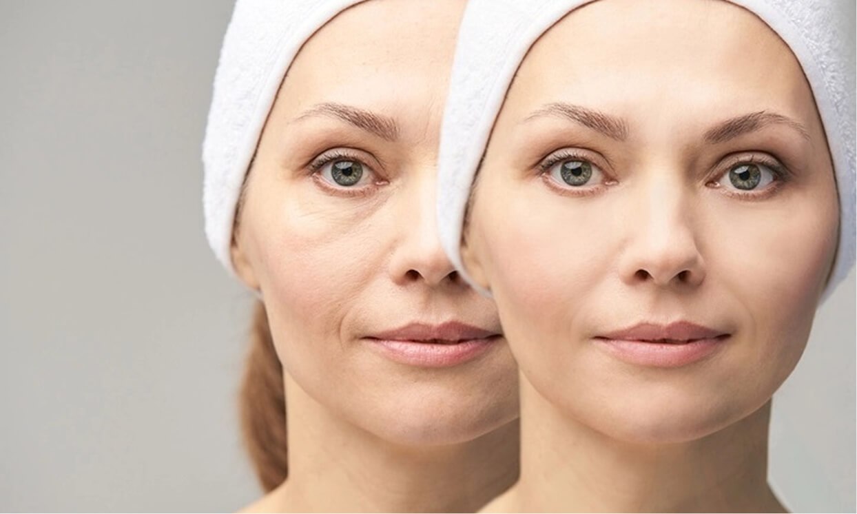 The Royal Lift Why choose The Royal Lift at rtwskin?