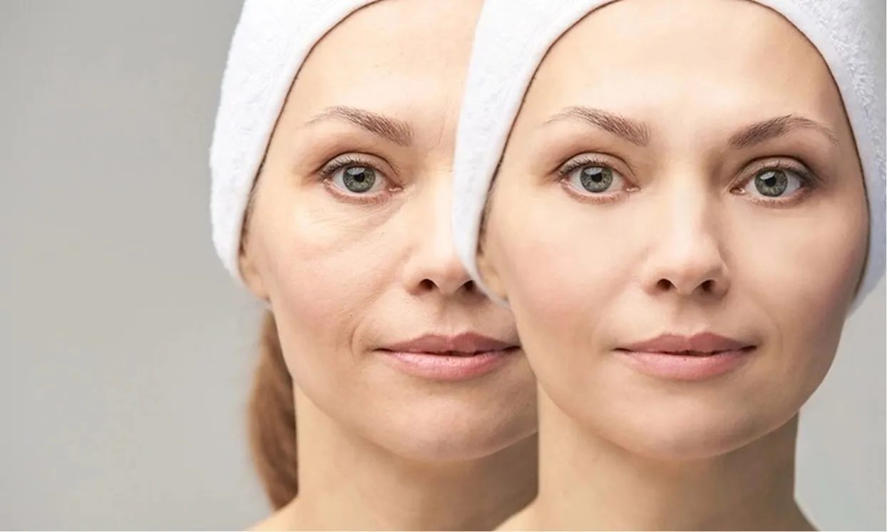 Why choose The Royal Lift at rtwskin?