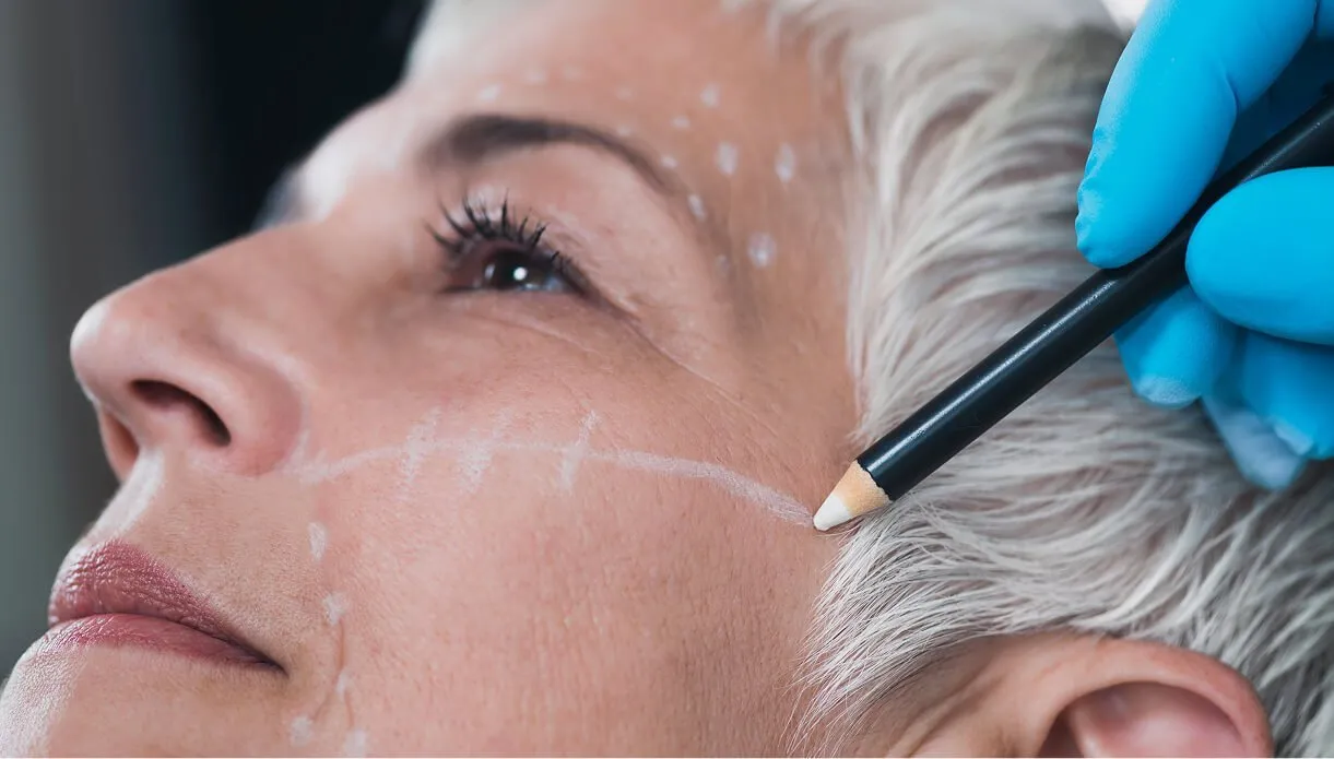 Thread lift cost and pricing
