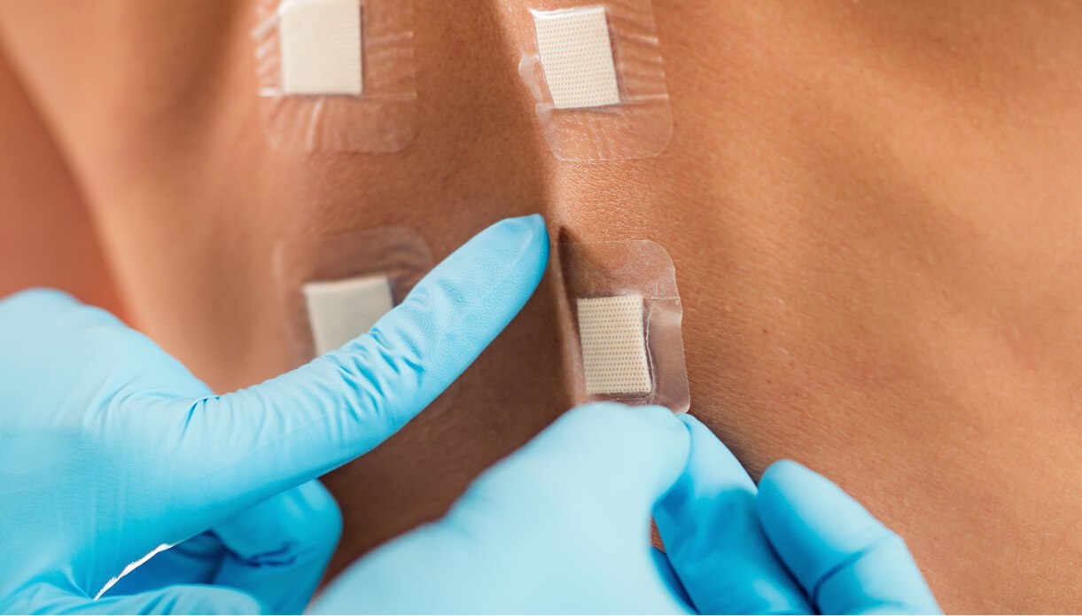 What to Expect During a Laser Test Patch What to Expect During a Laser Test Patch
