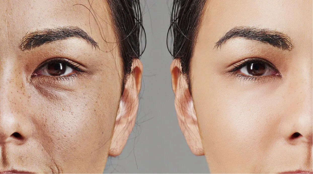 Why Choose rtwskin for Pigmentation Treatments?
