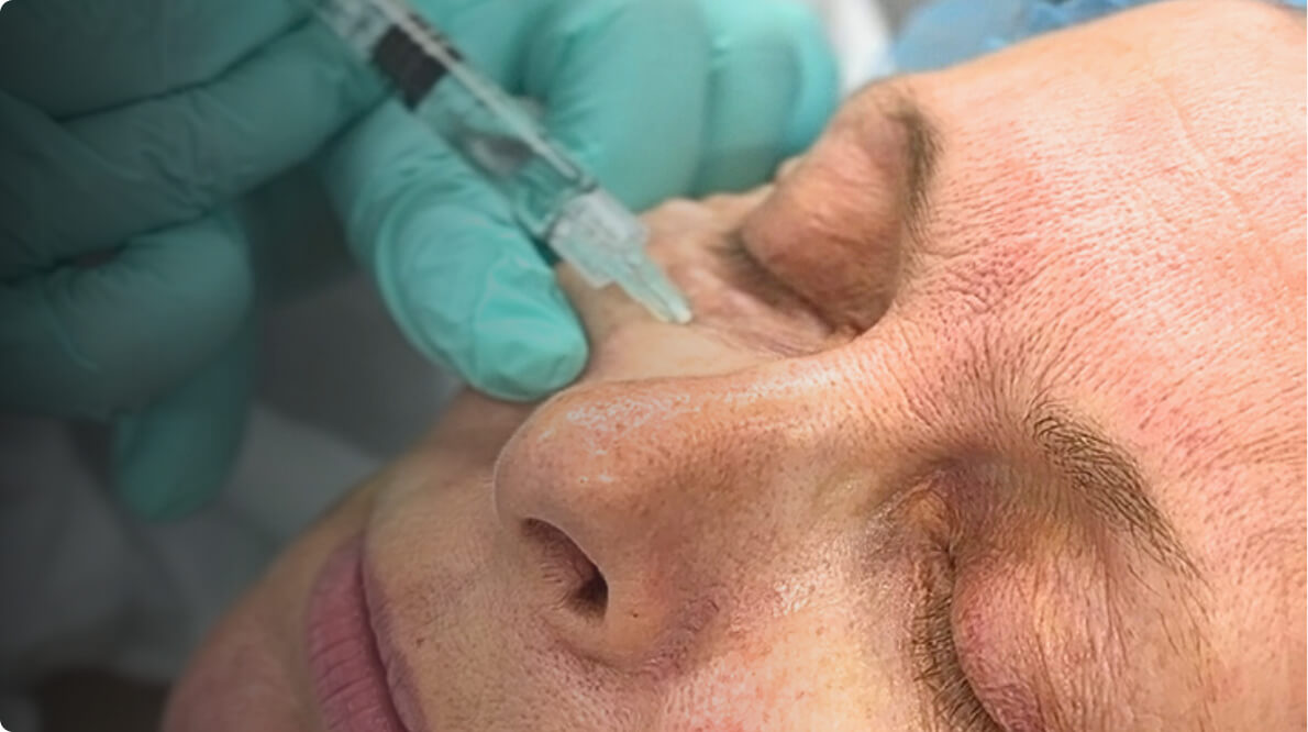 How to Reduce Bruising After Aesthetic Injections: Dr. Nina’s