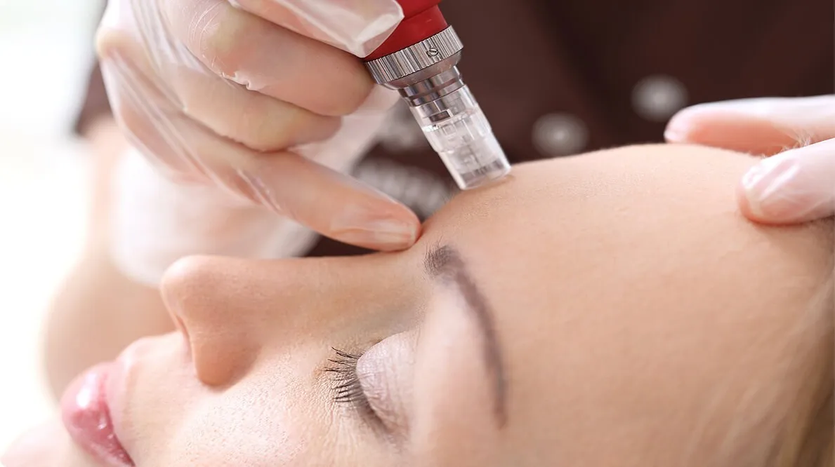 Mesotherapy 101: Everything you need to know about this Hydrating Injectable Treatment