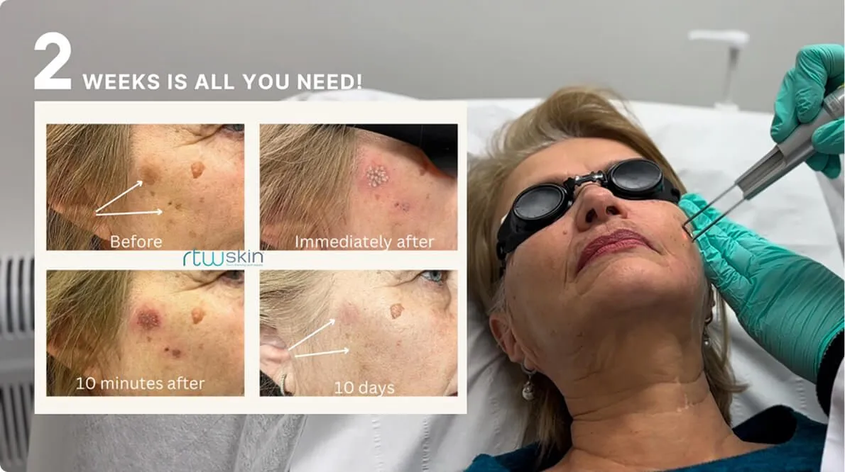 The Journey to Rejuvenation: A 67-Year-Old’s Story content post image