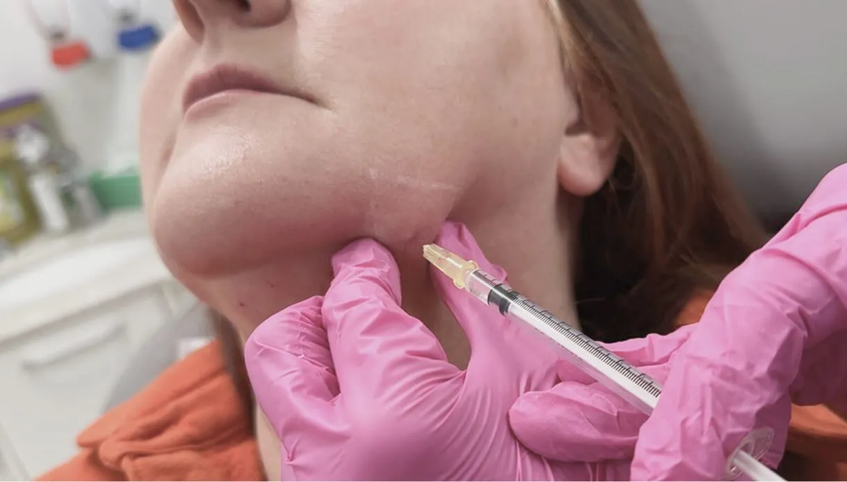 Belkyra: Effective Non-Surgical Treatment for Double Chin Reduction