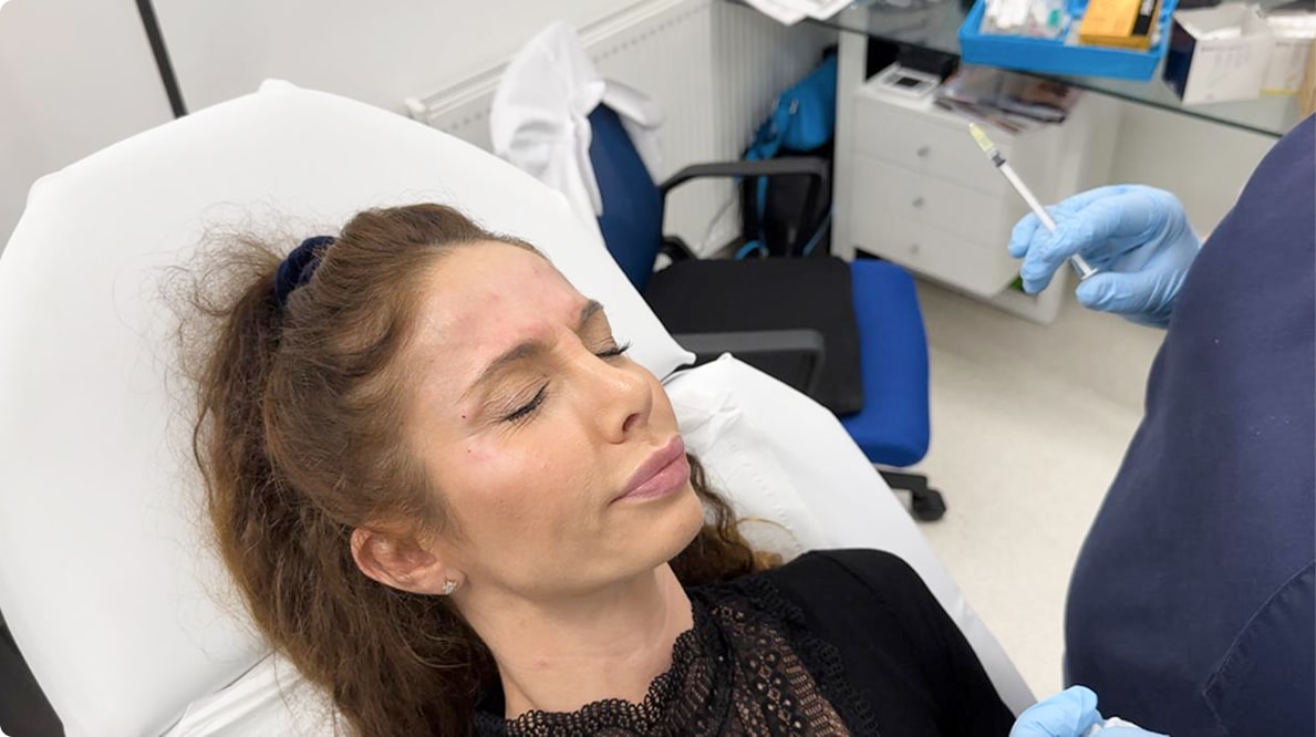 botox injections