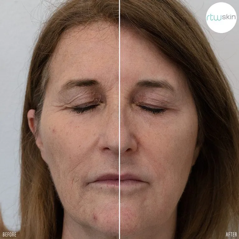 co2 before after
