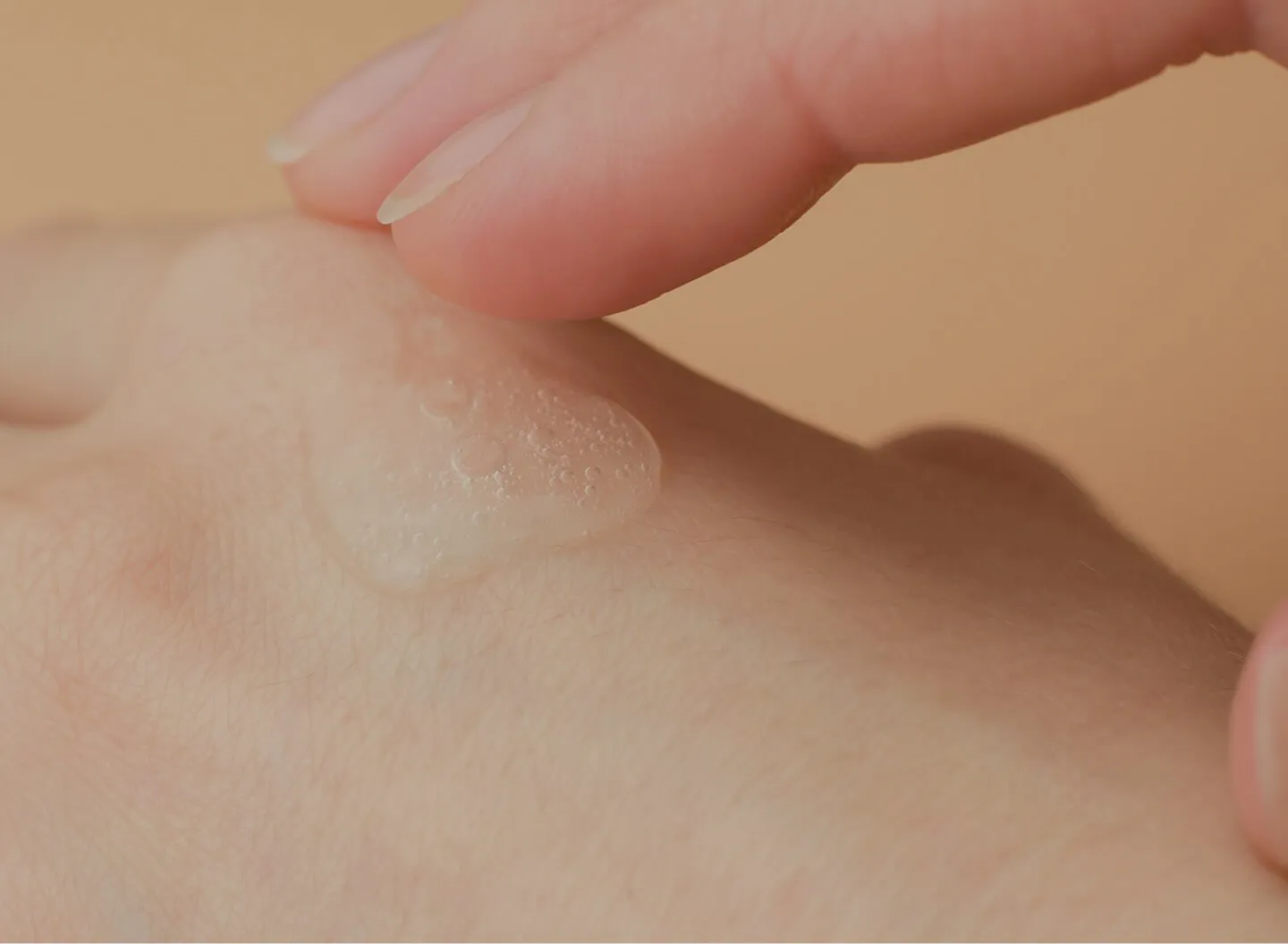 Infectious Skin Diseases