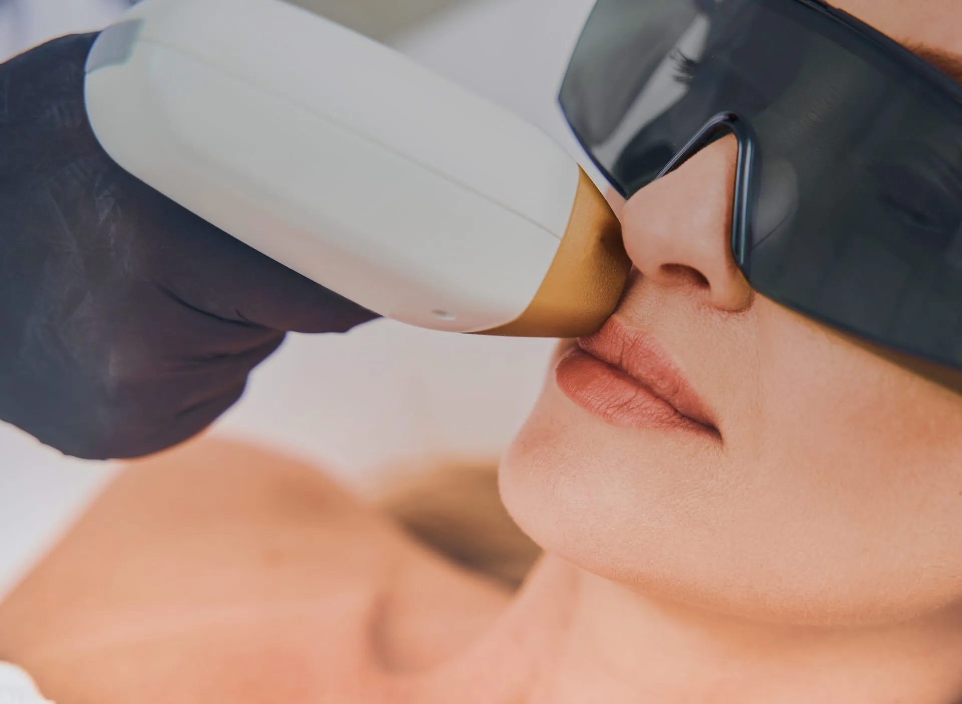 Laser Hair Removal