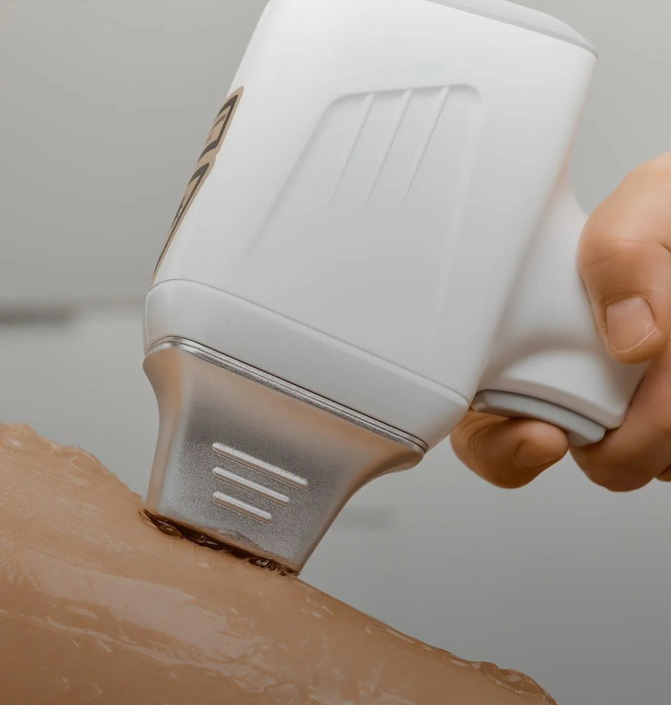 Laser or Electrolysis