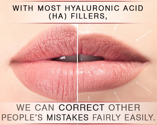 Female lips before and after augmentation procedure. Beauty conc How we put other people’s mistakes right content post image