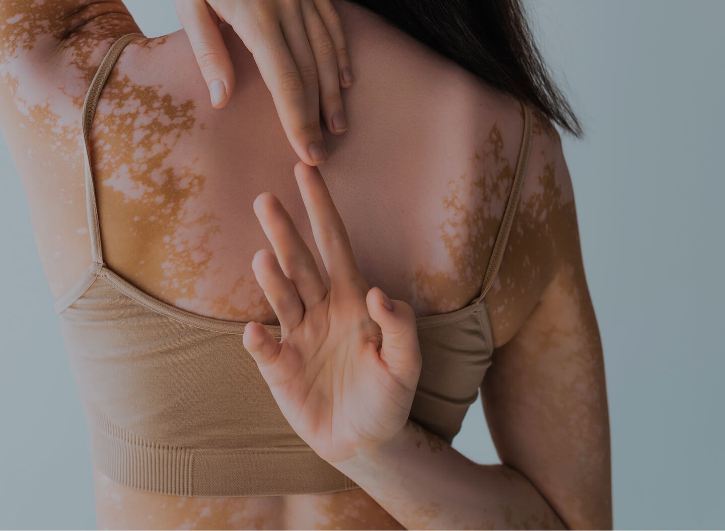 Skin-Disorders