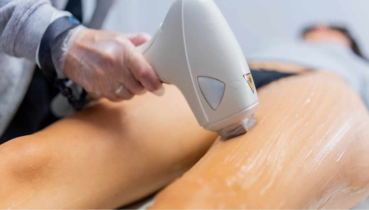 The difference between laser and ipl The difference between laser and ipl