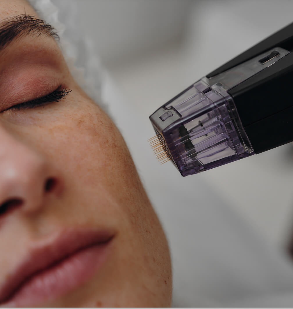 Tightening loose skin on the jawline